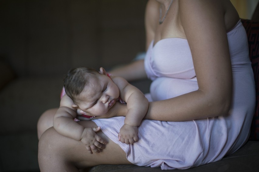 Dziecko dotknięte małogłowiem w brazylijskim Recife