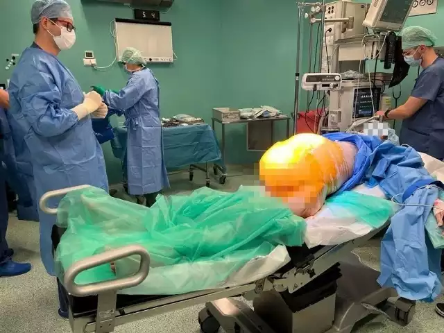 Lekarze ze Świdnicy usunęli pacjentce gigantycznego guza jajnika