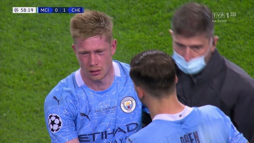 Kevin de Bruyne ma złamany nos i złamaną kość lewego...