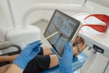 Kiedy należy wykonać tomografię komputerową zębów i żuchwy?