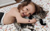 4-letnia Julka z Rzeszowa potrzebuje pilnej operacji kręgosłupa w USA. Pomóżmy! 
