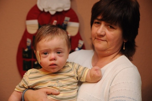 - Dzięki protezom Bartuś będzie mógł w miarę normalnie żyć - mówi jego mama, Jolanta Kurhofer.