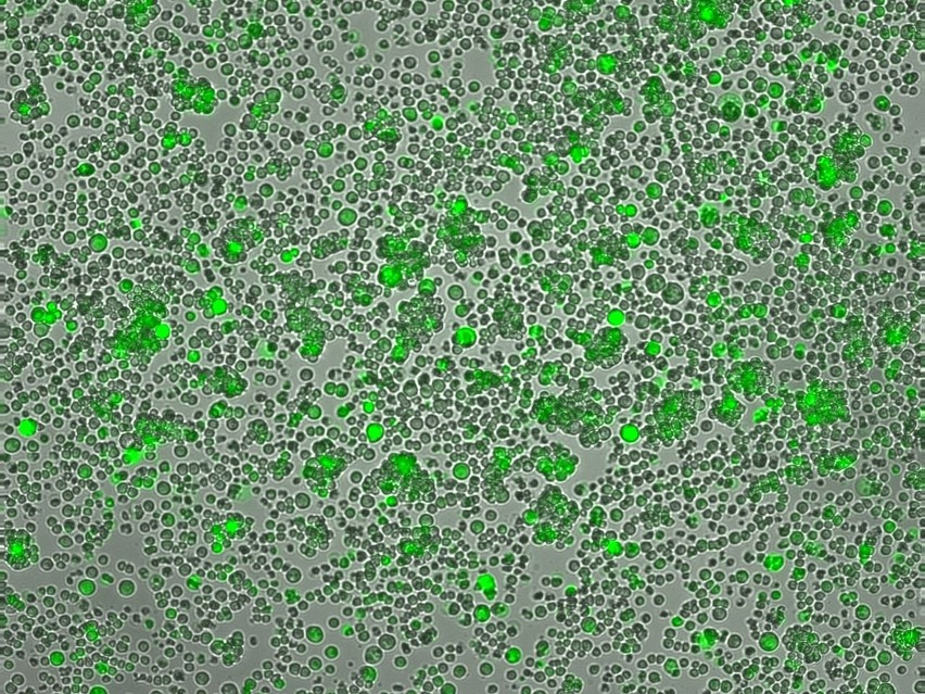 Zdjęcia komórek białaczkowych z hodowli prowadzonej w...