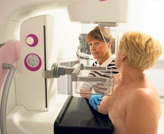 W Polsce wykrywa się ponad 12 000 nowych przypadków raka piersi rocznie, z czego 5 000 to przypadki śmiertelne