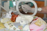 Najmniejszy noworodek w historii: Maleńkie bliźnięta skończyły miesiąc i przybierają na wadze