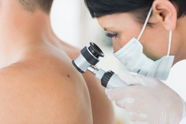 Oględziny skóry pod kątem niepokojących zmian wymagają użycia specjalnego urządzenia zwanego dermatoskopem.