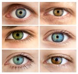 Heterochromia: przyczyny, objawy, leczenie. Heterochromia oczu: choroba czy wyjątkowa uroda?