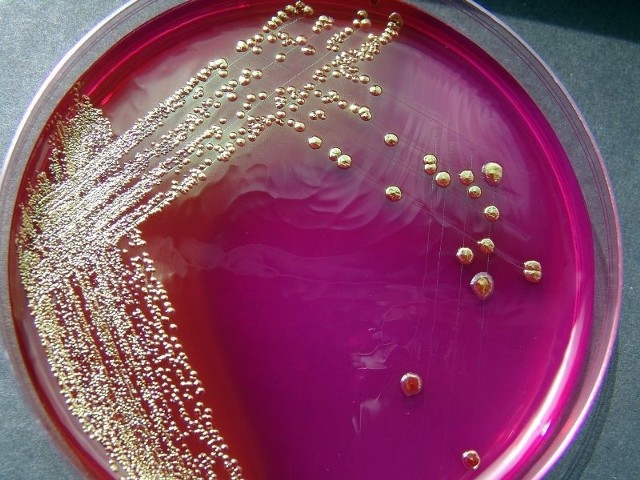 Epidemia EHEC. Tak wygląda laboratoryjna hodowla bakterii E.Coli