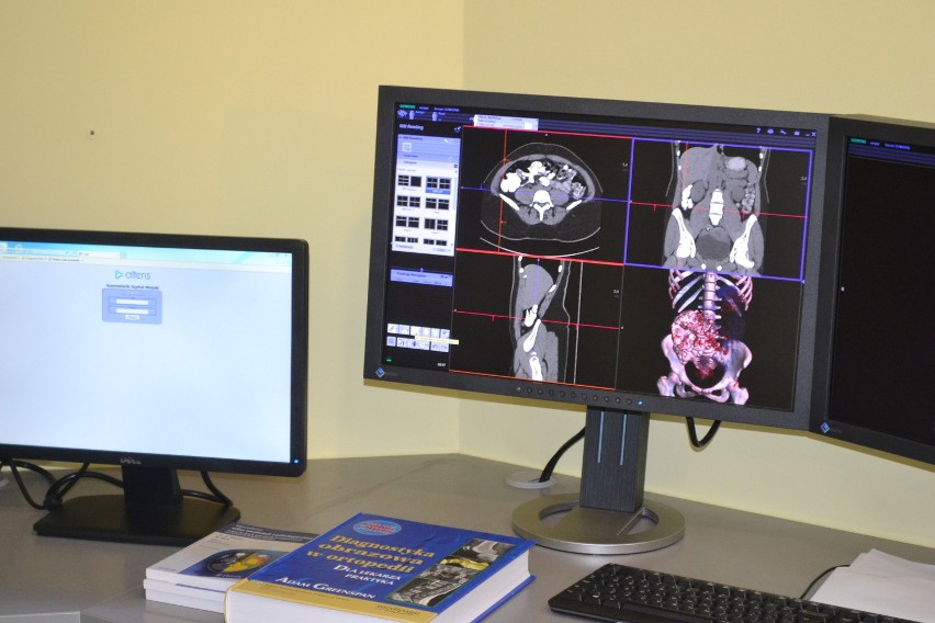 Szpital Miejski w Sosnowcu ma nowoczesny tomograf komputerowy [ZDJĘCIA]