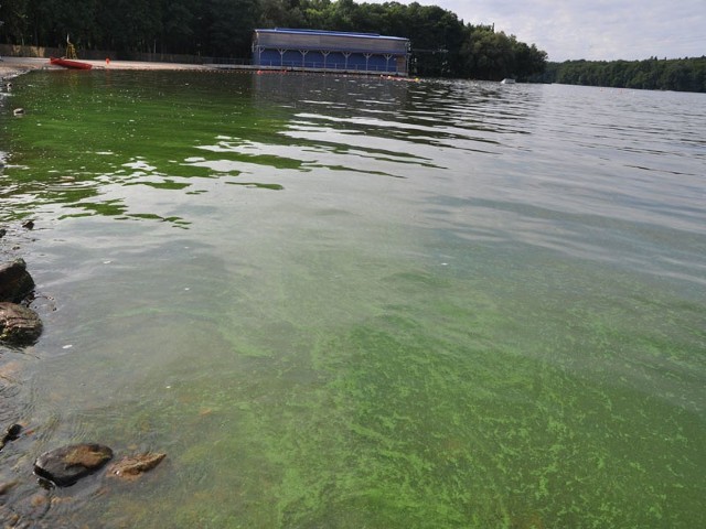 Szczecinecki inspektor sanitarny cofnął w piątek zakaz kąpieli na plaży wojskowej i tzw. "kołkach&#8221; nad jeziorem Trzesiecko. 