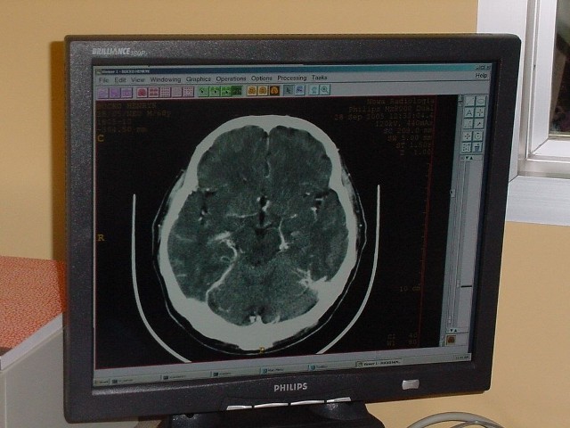 Tomograf komputerowy i cyfrowy aparat RTG zostaną umieszczone w nowym centrum radiologii