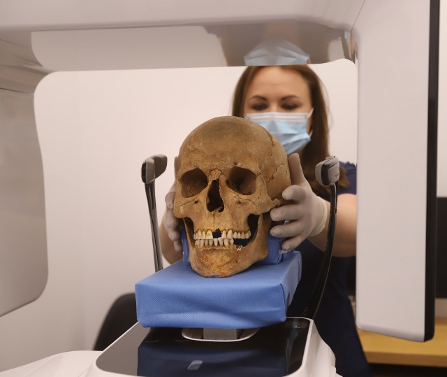 Dentyści z Dentim Clinic w Katowicach przebadali szczątki skazańców sprzed pół tysiąca lat.