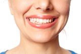Sprawdź, czy masz zdrowe zęby! Bezpłatne badania w Łodzi