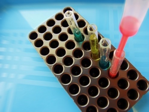Laboranci Sanepidu będą w stanie wykryć wirusa świńskiej grypy nowoczesnymi metodami