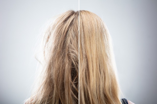Keratynowe prostowanie włosów to inaczej brazylijskie prostowanie włosów, czyli zabieg opierający się na odbudowującym działaniu keratyny wzmocnionym przez zastosowanie wysokiej temperatury.