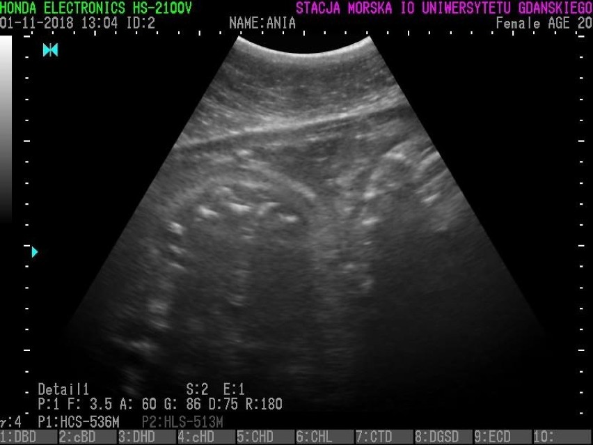 Foki z helskiego fokarium są w ciąży