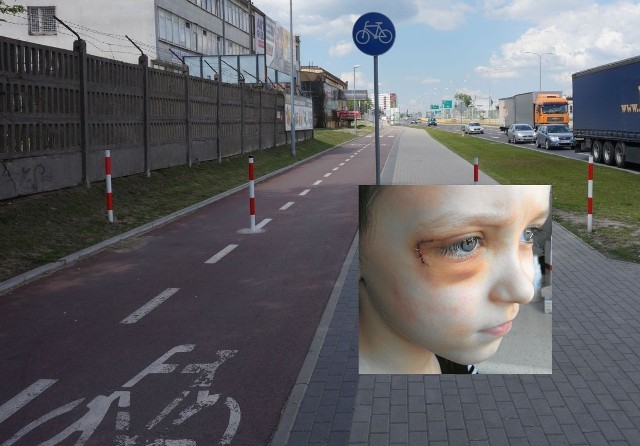Stawianie słupków na środku drogi  to chyba nie jest najlepszy pomysł, skoro stanowią zagrożenie dla zdrowia użytkowników ścieżki rowerowej - napisał radny Wojciech Koronkiewicz.