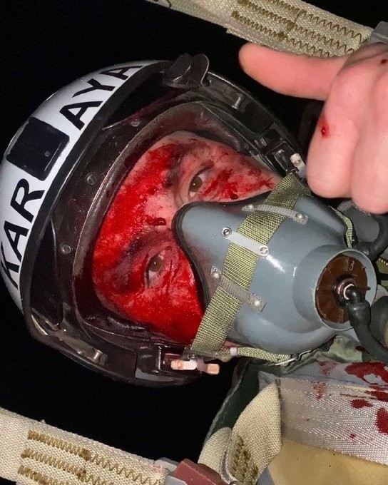 Odłamki irańskiego drona raniły twarz ukraińskiego pilota.