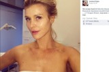 Joanna Krupa opowiada o wampirzym liftingu. Czy to boli? [WIDEO]