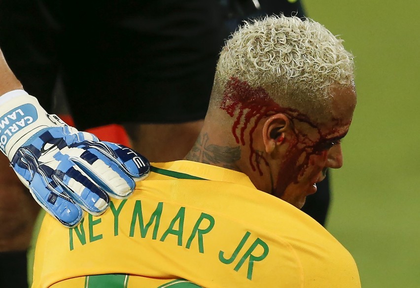 Brazylia - Boliwia 5:0. Neymar trafiony w łuk brwiowy