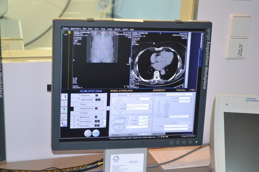 Szpital Miejski w Sosnowcu ma nowoczesny tomograf komputerowy [ZDJĘCIA]