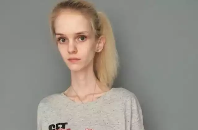 22-letnia Natalia Sykoś z Dobrodzienia cierpi na anoreksję. Szansą na powrót do zdrowia jest dla niej terapia w specjalistycznym ośrodku. Opolanka zaczęła leczenie, ale by je kontynuować musi zebrać blisko 18 tys. złotych.