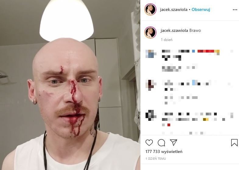 Uczestnik "GOGGLEBOXA" został pobity! Fryzjer Jacek Szawioła z zakrwawioną twarzą! Pokazał zdjęcia i filmy