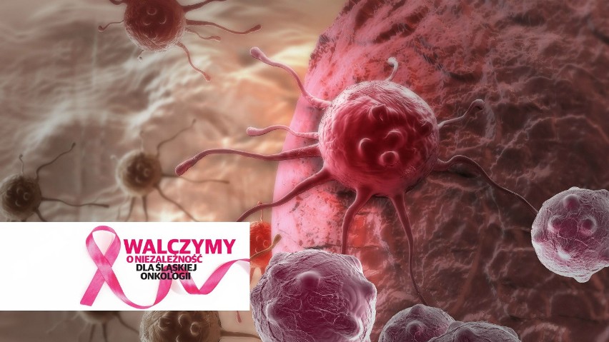 Jakie nowotwory najczęściej atakują kobiety i mężczyzn? [AKTYWNE ZDJĘCIE] Tak dla śląskiej onkologii