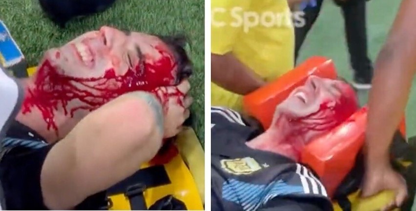 Masakra kibiców Argentyny z policją i Brazylijczykami: głowy we krwi. Infantino potępia, a CONMEBOL umywa ręce