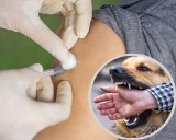 Co robić, gdy ugryzie cię nieszczepiony pies lub dzikie zwierzę? Ta choroba zabija, ratuj swoje życie! Takie są objawy wścieklizny u ludzi