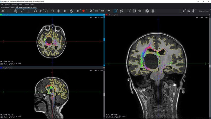 Model mózgu z drukarki 3D