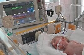 Lekarze zielonogórskiej neonatologii codziennie ratują tak malutkie dzieci. Czy i w tym roku nasi Czytelnicy przyznają oddziałowi pierwsze miejsce w plebiscycie na najlepszy oddział szpitalny?