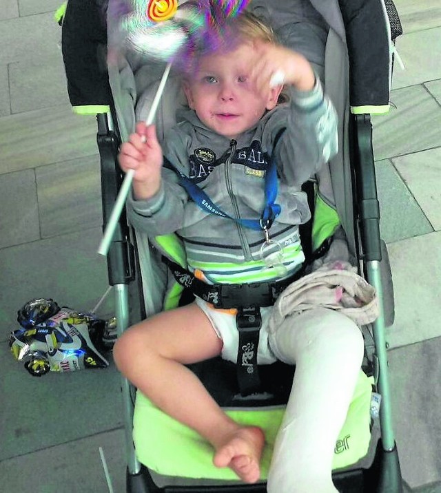 Dwuletni Antoś Różycki z Radomia urodził się z wadą lewej stopy, zwanej końsko-szpotawą. Jest już po kolejnej operacji.