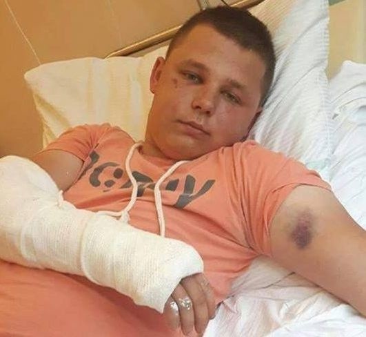 18-letni Piotr po pobiciu przez kilka dni przebywał w szpitalu.