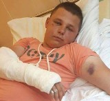 Brutalne pobicie w Radomiu. 18-latek w szpitalu, koledzy apelują o pomoc w znalezieniu sprawców 