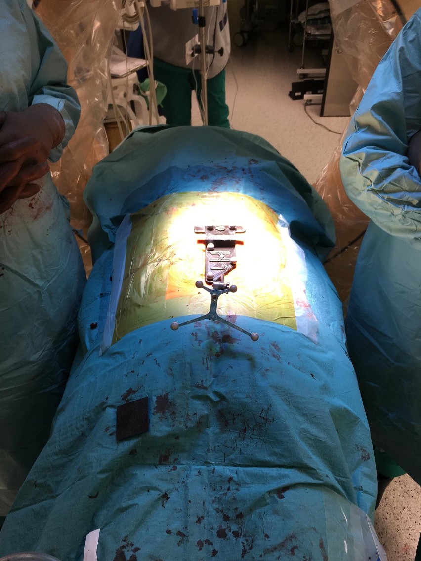Operacje kręgosłupa z 3D uwolnią pacjentów od bólu