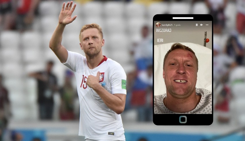 Kamil Glik stracił zęby. Opublikował selfie przed i po wizycie u stomatologa [ZDJĘCIA]