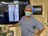 Lubuskie może być dumne! W zielonogórskim szpitalu przeprowadzono kolejną nowatorską operację. Medycy pokonali zaawansowanego tętniaka aorty