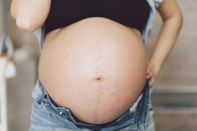 Linea negra w ciąży może mieć ciemnobrązowy kolor, ale bywa również beżowa lub ledwo dostrzegalna. U niektórych kobiet w ciąży czarna kresa nie pojawia się wcale.