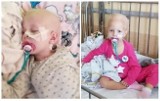 3-letnia Natalka walczy z rakiem. Trwa zbiórka