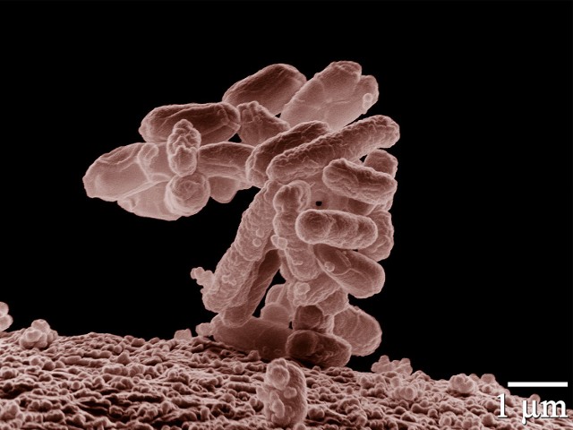 Pałeczki okrężnicy - bakterie coli