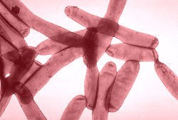 Bakterie LegionelliLegionella w domowych instalacjach: sposoby walki z nią