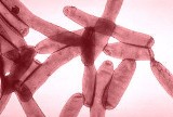 Legionella w domowych instalacjach: sposoby walki z nią 