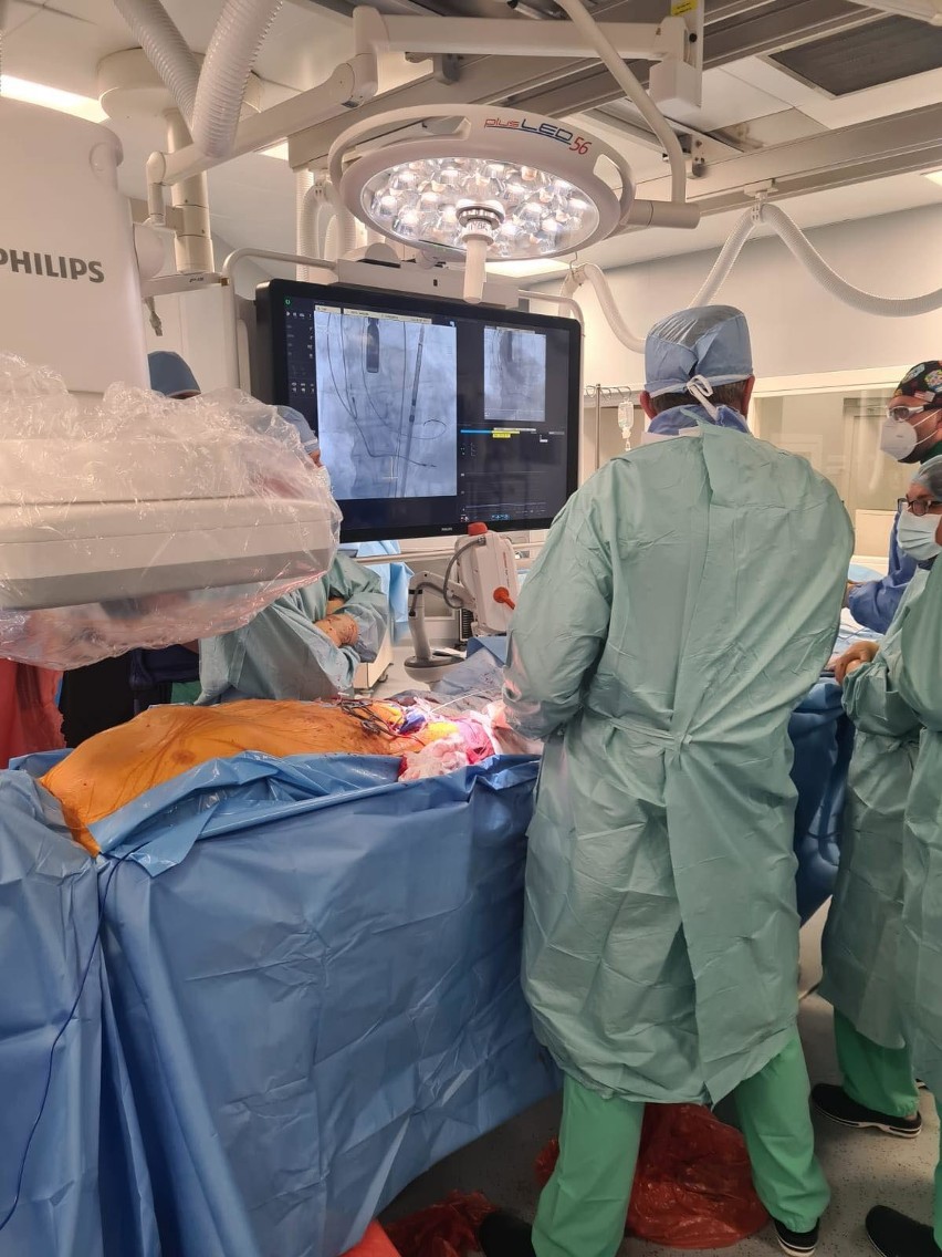 Innowacyjny zabieg ratujący życie wykonano po raz pierwszy w Wojewódzkim Szpitalu Zespolonym w Kielcach (ZDJĘCIA)