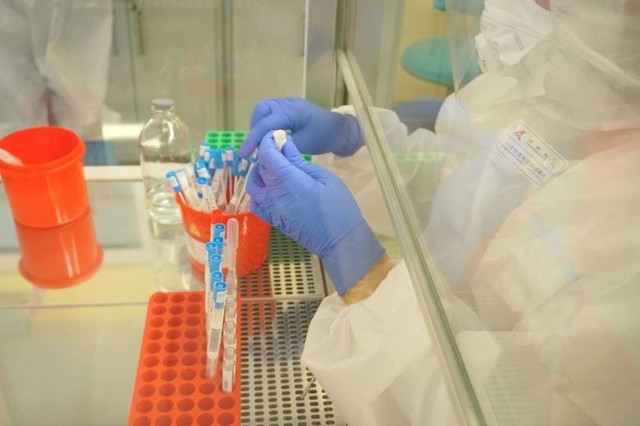Porozumienie Zielonogórskie apeluje do ministra zdrowia o zmianę decyzji, dotyczącą zlecania wykonywania testów na koronawirusa