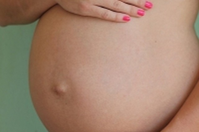 Kobiety, które ćwiczą w czasie ciąży, szybciej wracają do formy po porodzie niż te, które  unikały ruchu. Jednak przed rozpoczęciem gimnastyki koniecznie trzeba powiadomić o swoich planach ginekologa i upewnić się, że nie ma przeciwwskazań do ćwiczeń.