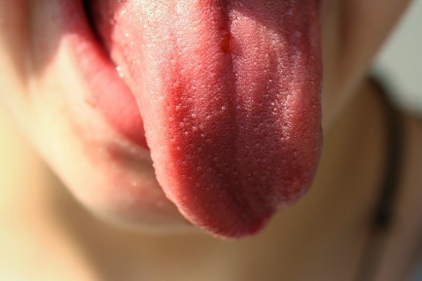 Gładki, gruby i błyszczący język...