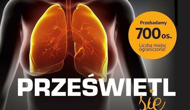 Fundacja Jesteśmy Blisko zachęca mieszkańców do prześwietlenia płuc. Są jeszcze wolne miejsca.