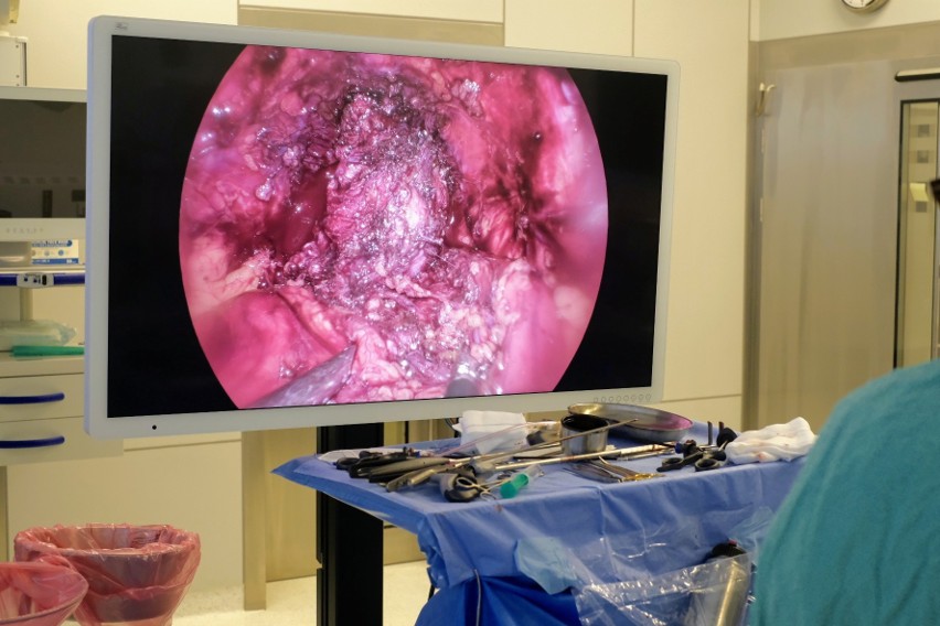 Nowy laparoskop z torem wizyjnym w technologii 4K pozwala na...