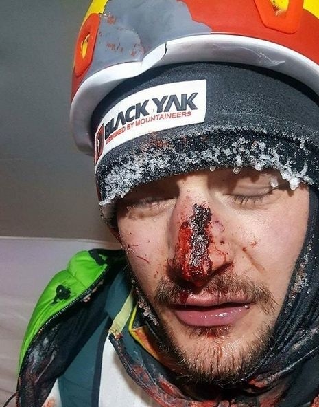 Himalaista Adam Bielecki został uderzony spadającym...